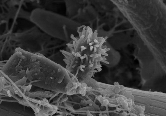 显微镜下细节之美：沙粒上的细菌部落